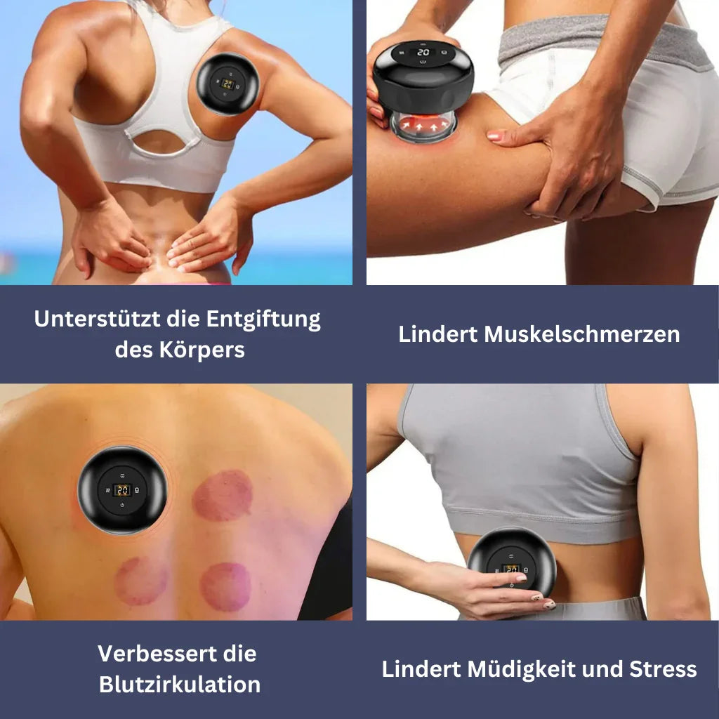 Smart Cupping Massager