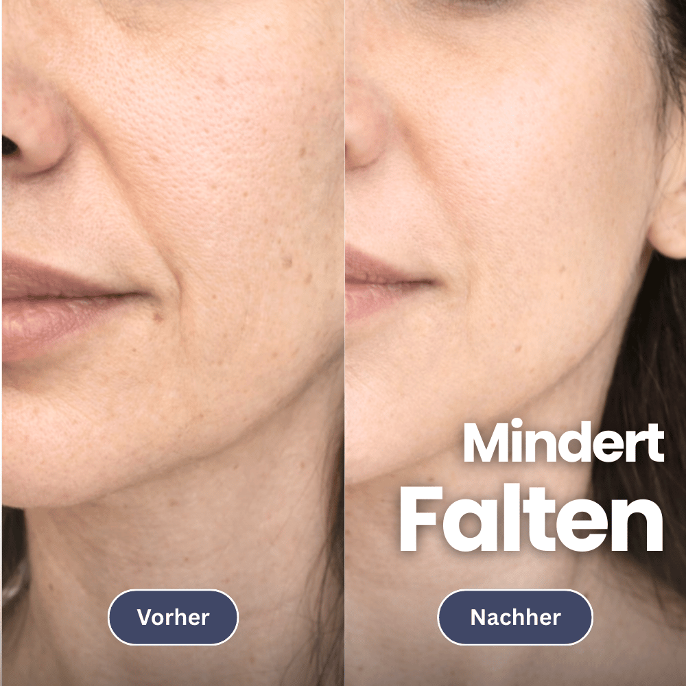 Microneedling Infusion Set for Firmer Skin