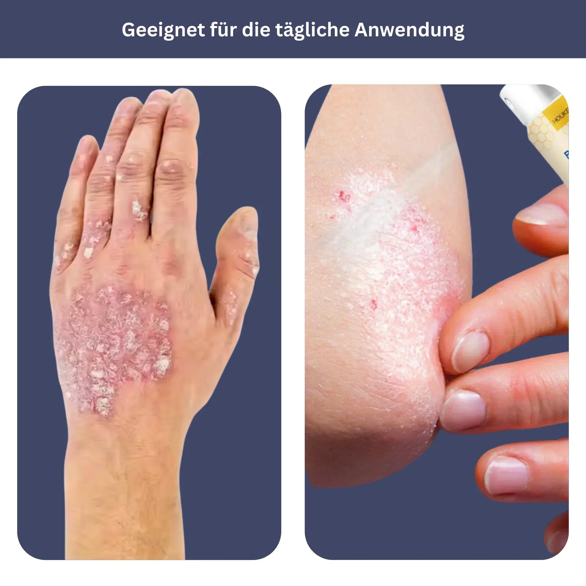 HOUKEA Bee Venom Soothing Spray