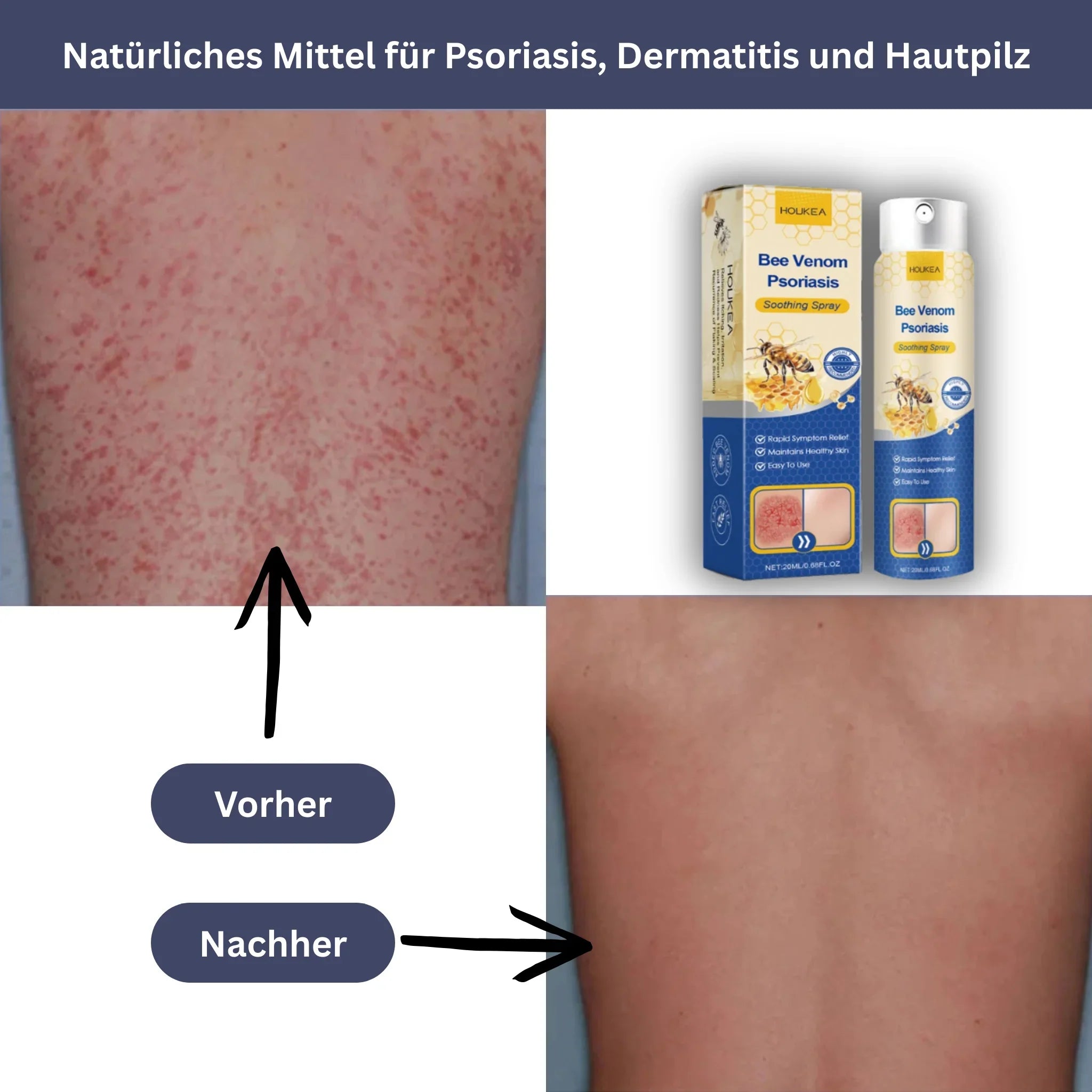 HOUKEA Bee Venom Soothing Spray