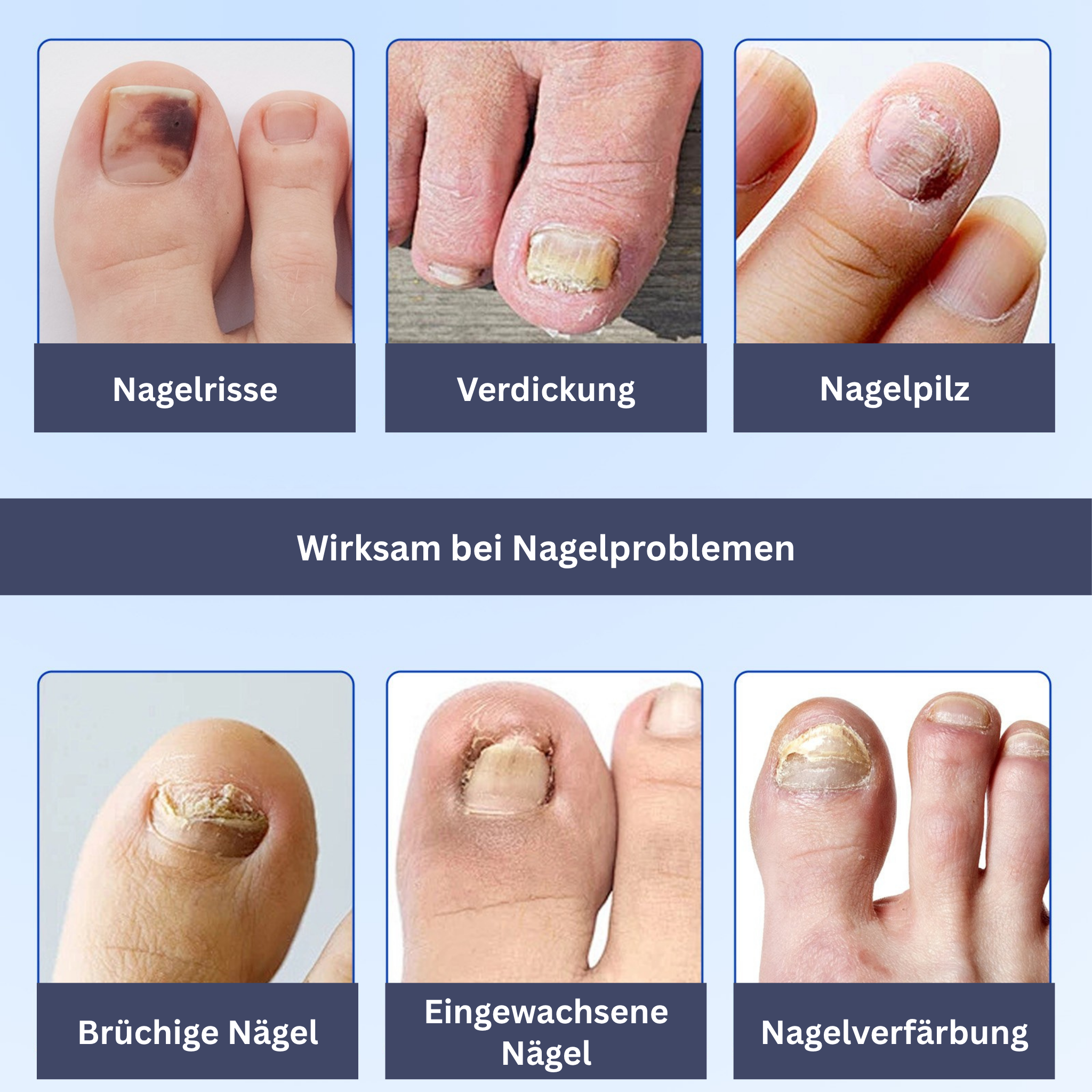 Nail Care Hydrogel Patches