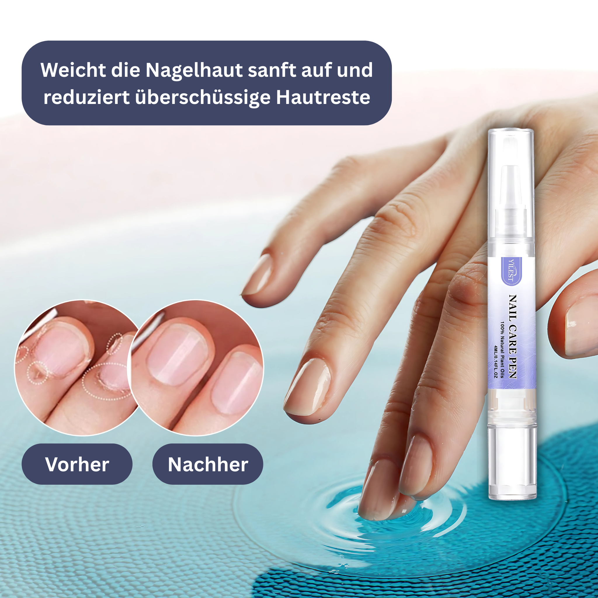 YILEST Natural Nail Care Pen