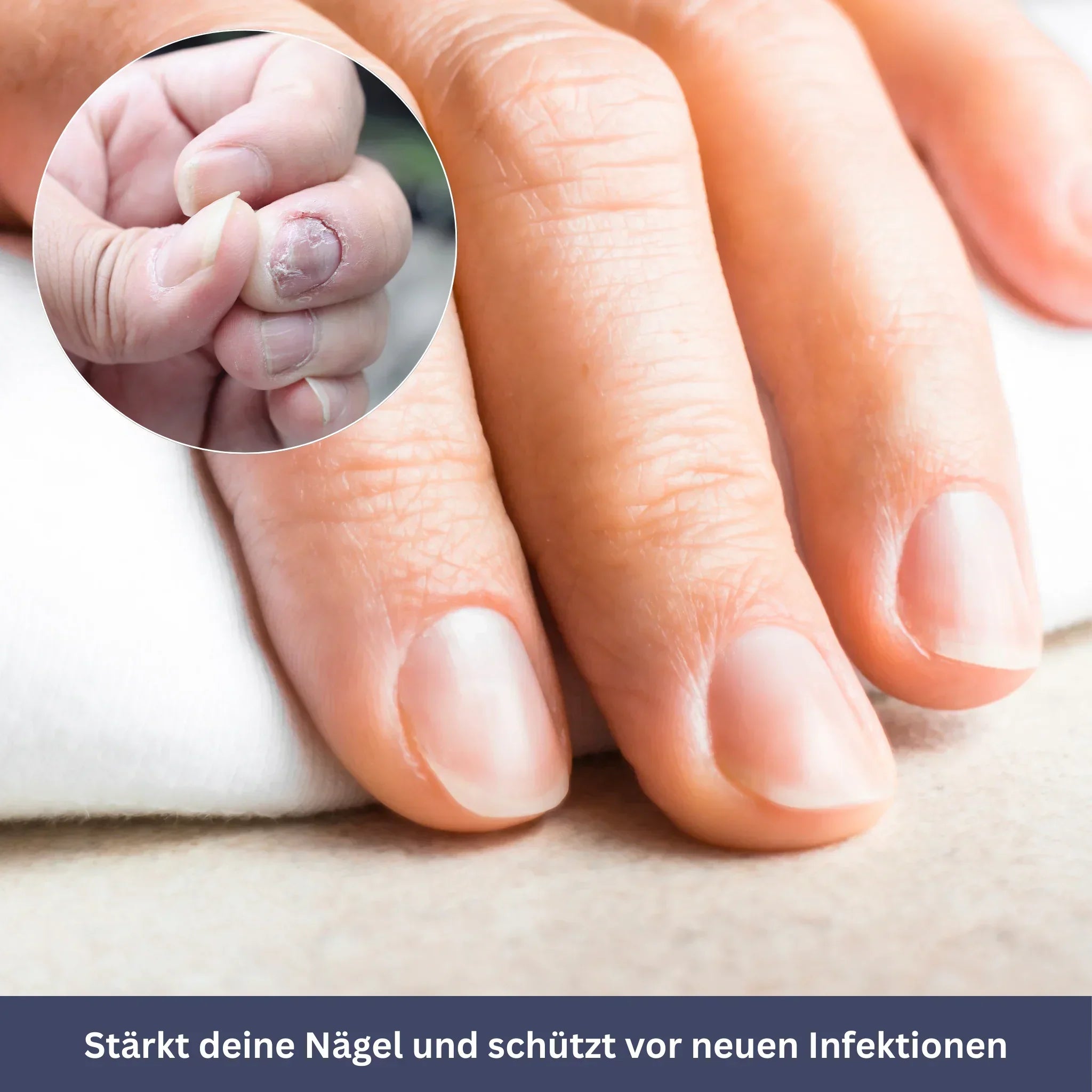 NailPen – Repair Pen for Nail Fungus & Inflammation